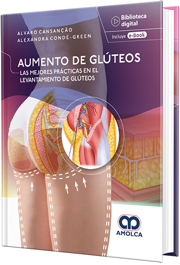 Aumento de glúteos. Las mejores prácticas en el levantamiento de glúteos