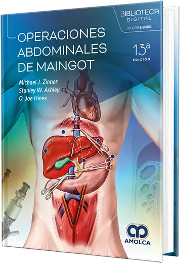 Operaciones abdominales de Maingot