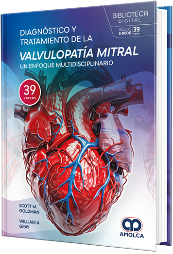 Diagnóstico y tratamiento de la valvulopatía mitral