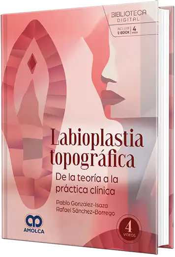 Labioplastia topográfica. De la teoría a la práctica clínica