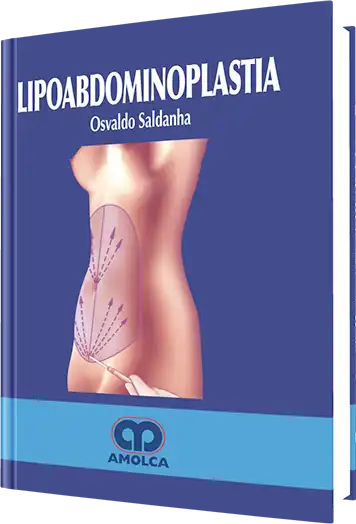 Lipoabdominoplastia