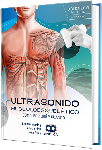 Ultrasonido musculoesquelético. Cómo, por qué y cuándo