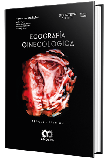 Ecografía ginecológica