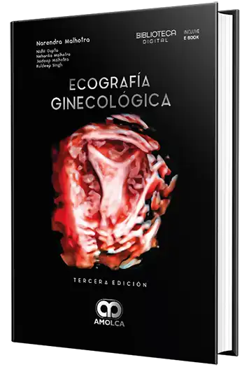 Ecografía ginecológica