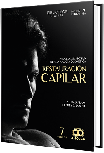 Procedimientos en Dermatología Cosmética: Restauración Capilar