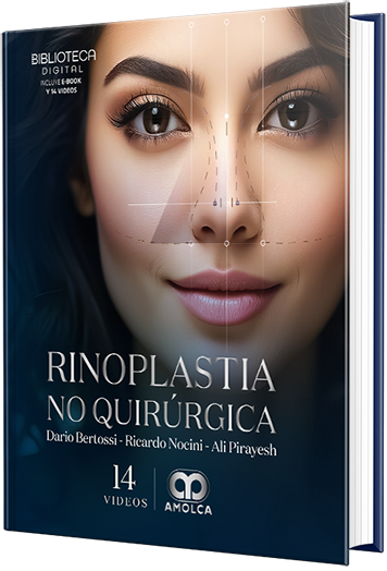 Rinoplastia no quirúrgica