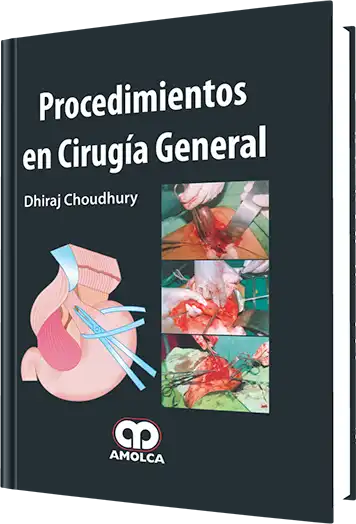 Procedimientos en Cirugía General