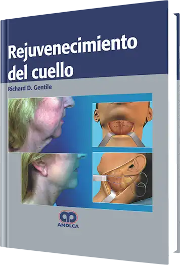 Rejuvenecimiento del Cuello