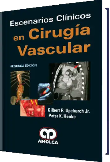 Escenarios Clínicos en Cirugía Vascular. 2 Edición