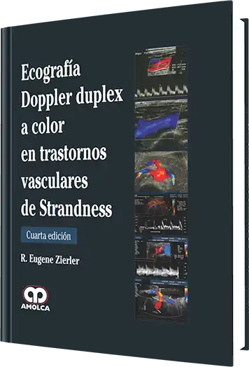 Ecografía Doppler Duplex a Color en Trastornos Vasculares de Strandness. 4 Edición