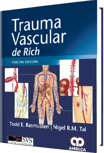 Trauma Vascular de Rich. 3 Edición