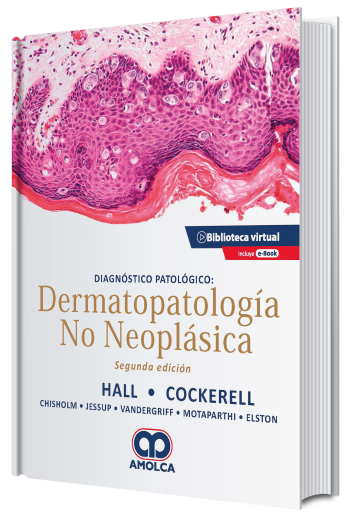 Diagnóstico Patológico: Dermatopatología no Neoplásica. 2 Edición