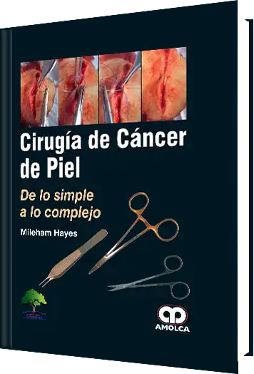 Cirugía de Cáncer de Piel