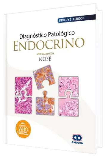 Diagnóstico Patológico Endocrino 2 Edición