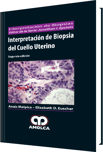 Interpretación de Biopsia del Cuello Uterino 2 Edición