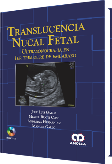 Translucencia Nucal Fetal