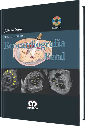 Ecocardiografía Fetal 2 Edición