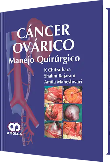 Cáncer Ovárico. Manejo Quirúrgico