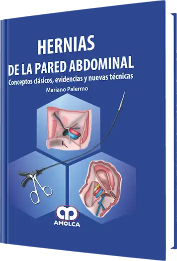 Hernias de la Pared Abdominal