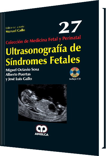 Ultrasonografía de Síndromes Fetales. Volumen 27