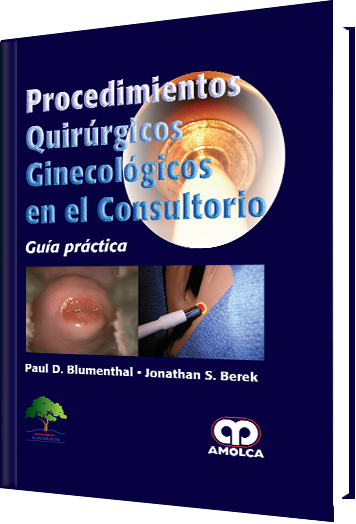 Procedimientos Quirúrgicos Ginecológicos en el Consultorio
