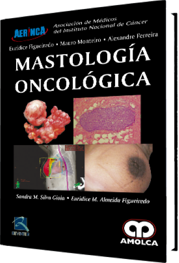Mastología Oncológica
