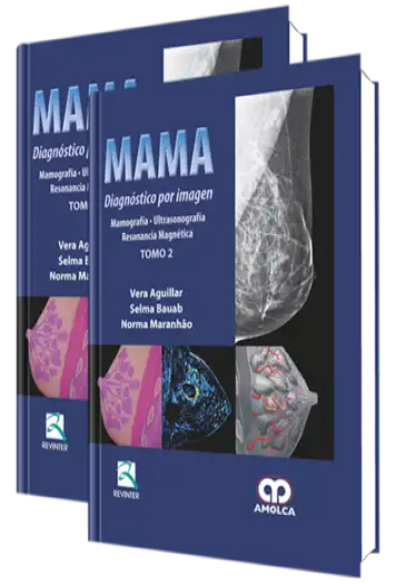 Mama. Diagnóstico por Imagen