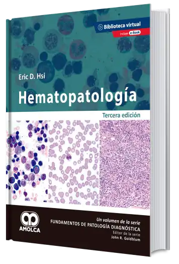 Hematopatología. 3 Edición