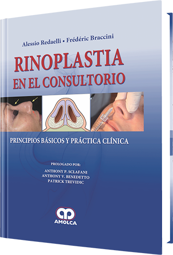 Rinoplastia en el Consultorio