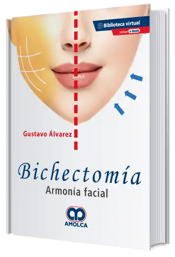 Bichectomía. Armonía Facial