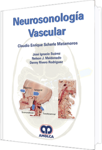 Neurosonología Vascular