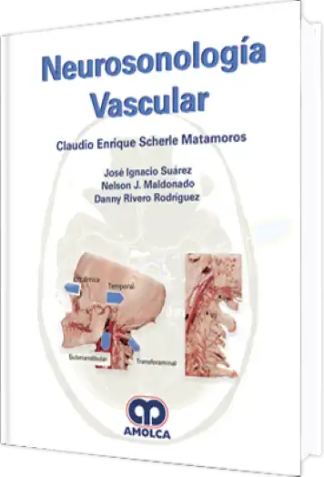 Neurosonología Vascular