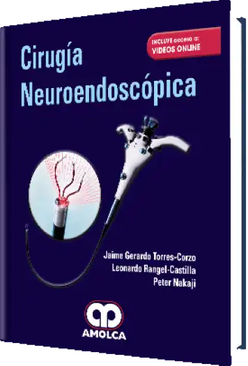 Cirugía Neuroendoscópica