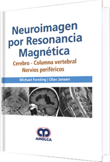 Neuroimagen por Resonancia Magnética