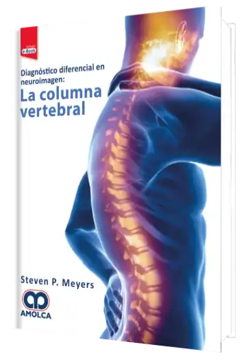 Diagnóstico Diferencial en Neuroimagen: La Columna Vertebral