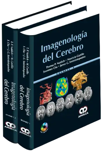 Imagenología del Cerebro