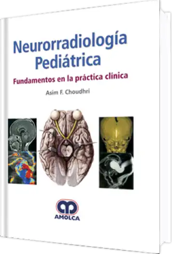 Neurorradiología Pediátrica