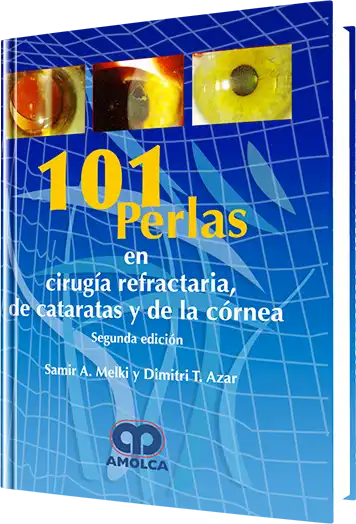 101 Perlas en Cirugía Refractaria, de Cataratas y de la Córnea. 2 Edición