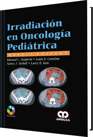 Irradiación en Oncología Pediátrica. 5 Edición