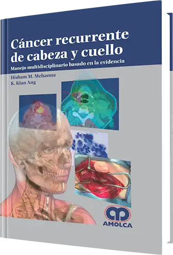 Cáncer Recurrente de Cabeza y Cuello