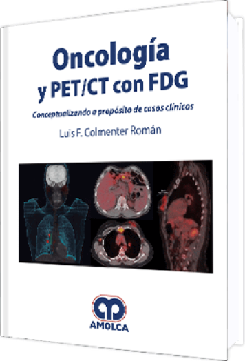 Oncología y PET / CT con FDG