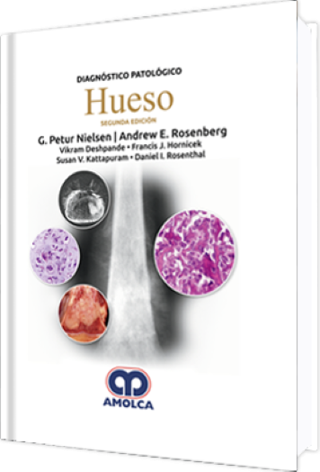 Diagnóstico Patológico: Hueso 2 Edición