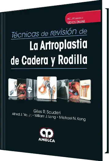 La Artroplastia de Cadera y Rodilla