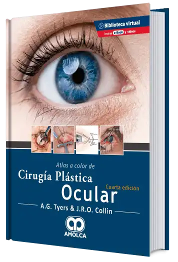 Atlas a Color de Cirugía Plástica Ocular. 4 Edición