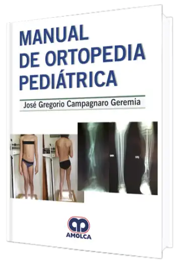 Manual de Ortopedia Pediátrica