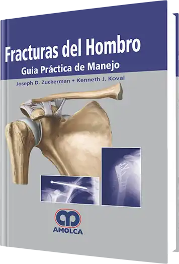 Fracturas del Hombro. Guía Práctica de Manejo