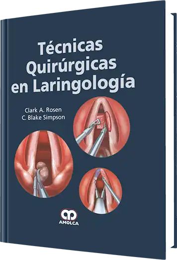 Técnicas Quirúrgicas en Laringología