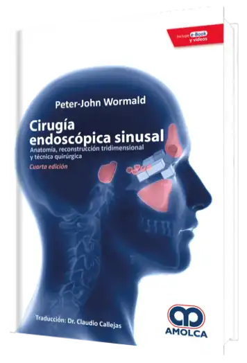 Cirugía Endoscópica Sinusal.  4 Edición