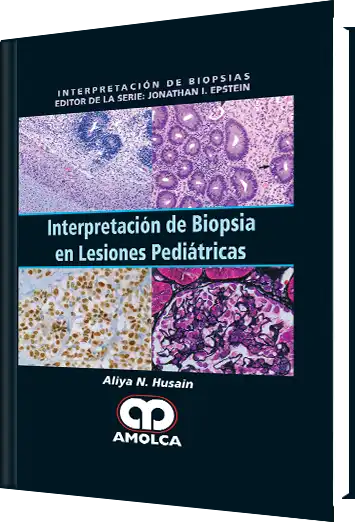 Interpretación de Biopsia en Lesiones Pediátricas