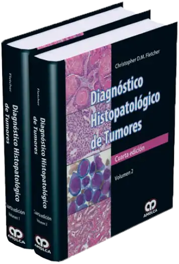 Diagnóstico Histopatológico de Tumores. 4 Edición